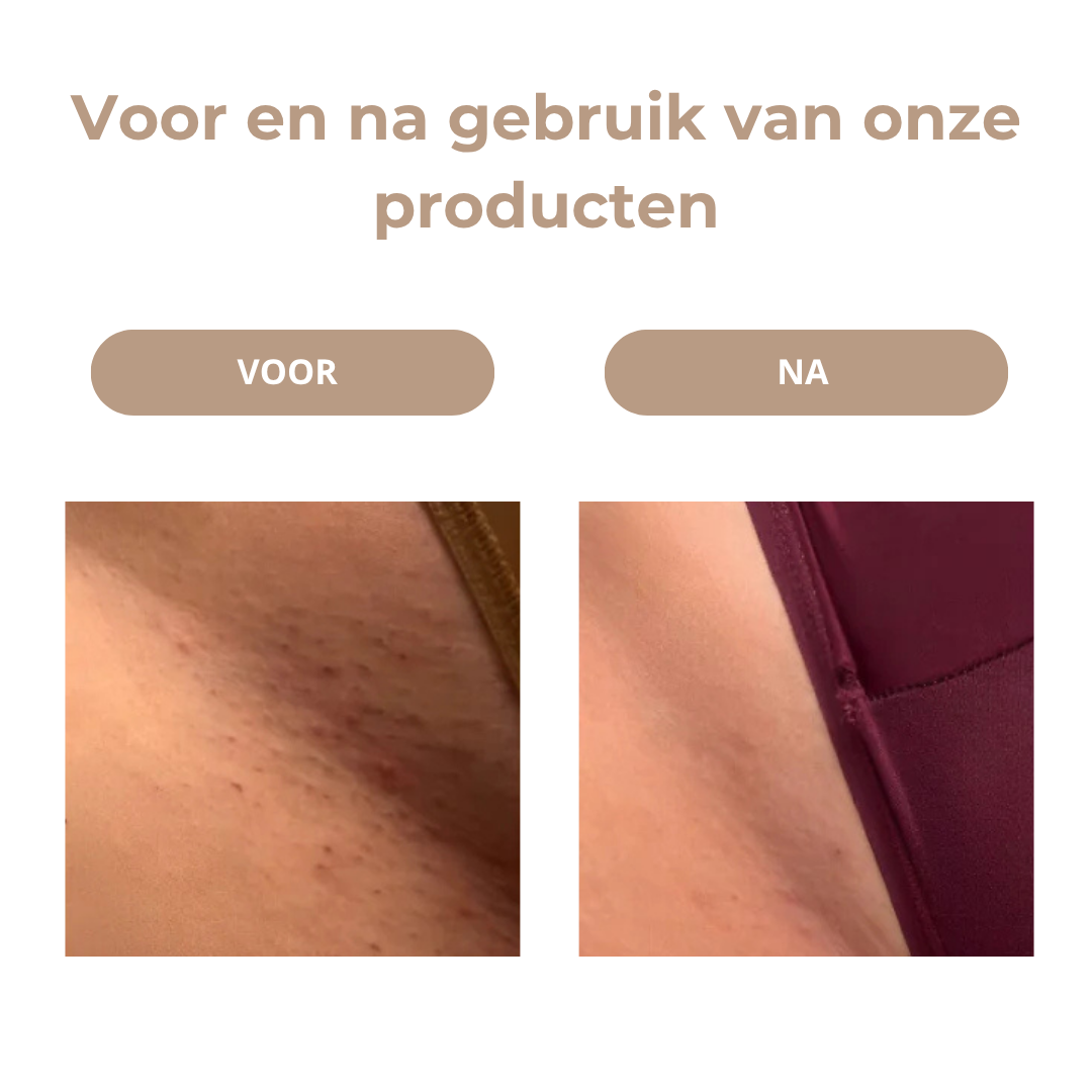 Veloura™ SilkShave Bikini Trimmer