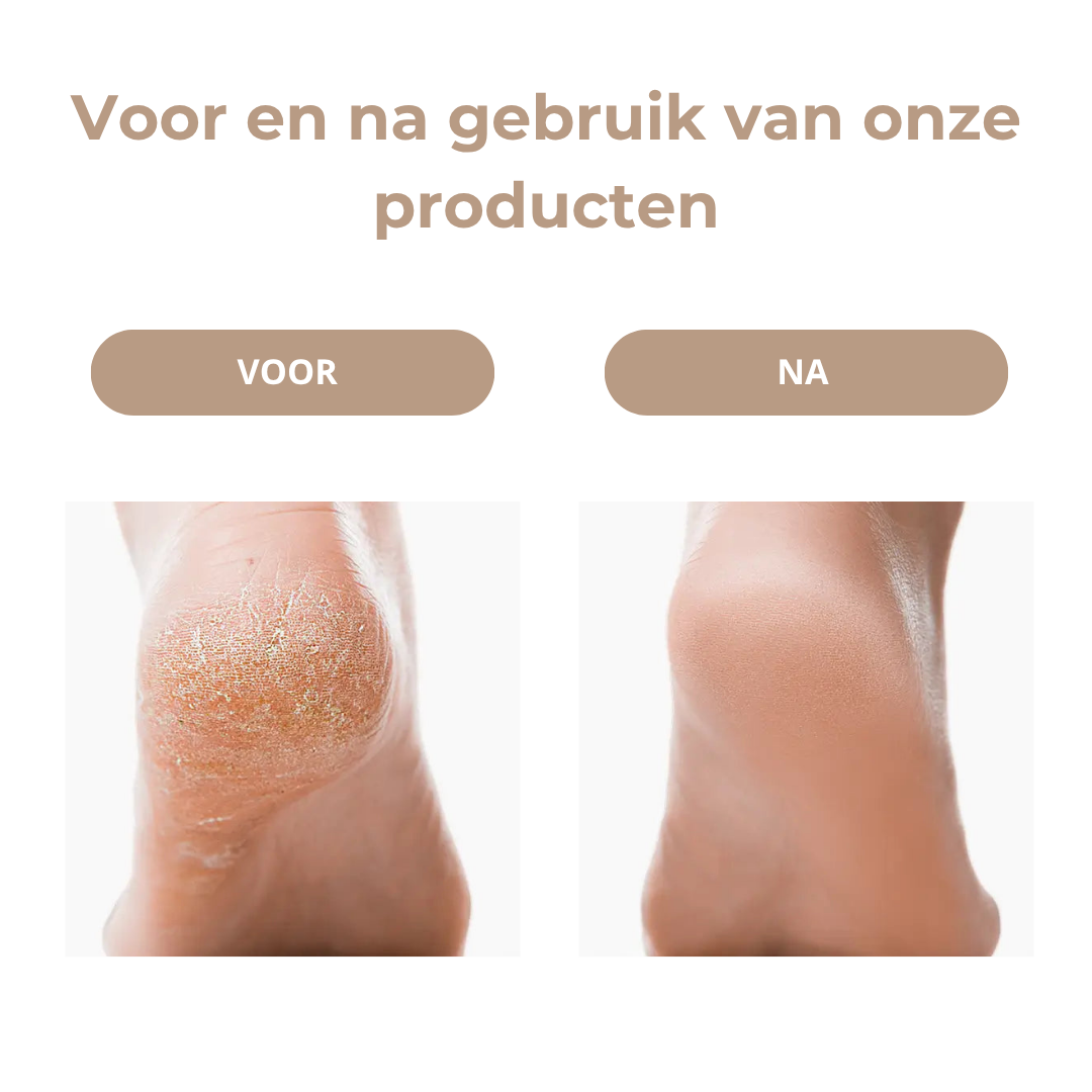 Soleva™ VelvetStep Pro