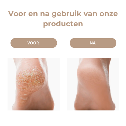 Soleva™ VelvetStep Pro