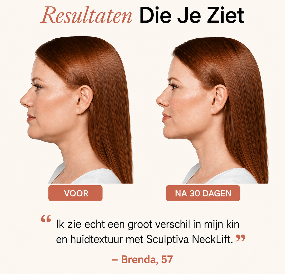 Sculptiva NeckLift - LED Hals & Kinn Behandlung