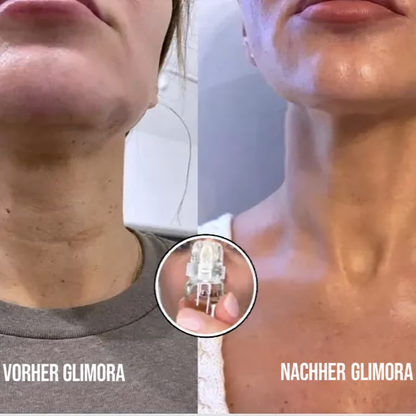 Glimora™ - Micro-Infusion Gesichtsset