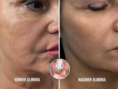 Glimora™ - Micro-Infusion Gesichtsset
