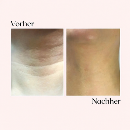 Glimora™ - Micro-Infusion Gesichtsset