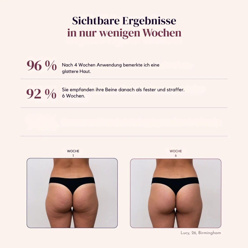 Sveltiva™ ContourFit - 3D-gestrickte Konturleggings mit hohem Bund